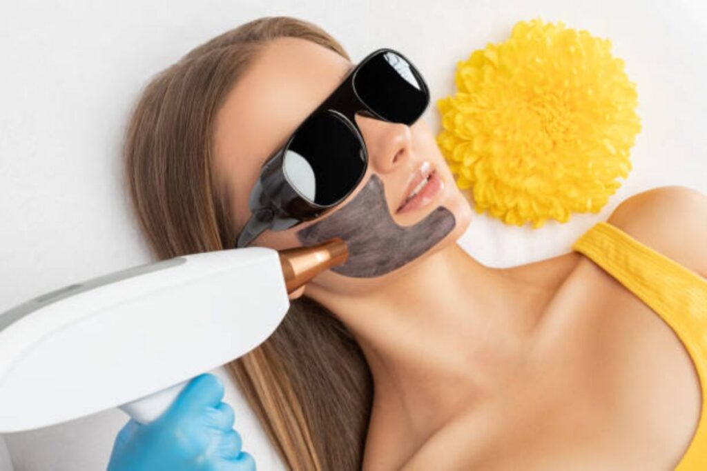 Charcoal Peel